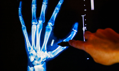 Was it funny? In Sweden, implant COVID chips